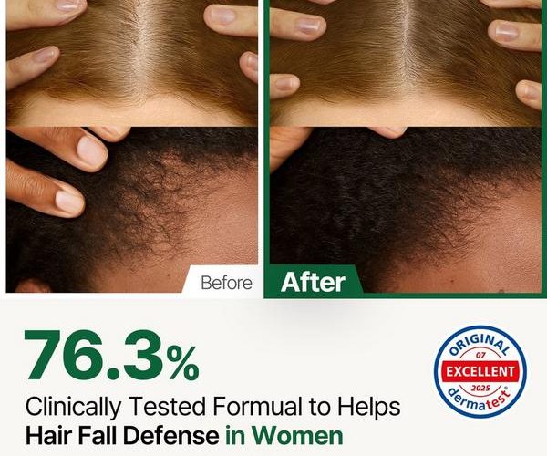 Hair Tonic: A Complete Guide to Scalp Health and Hair Growth