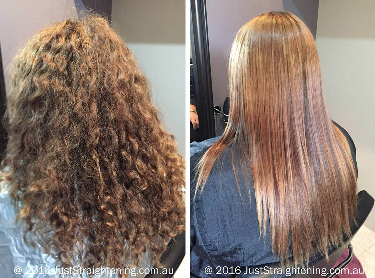 Permanent Straightening: History, Health Risks, and Safer Alternatives